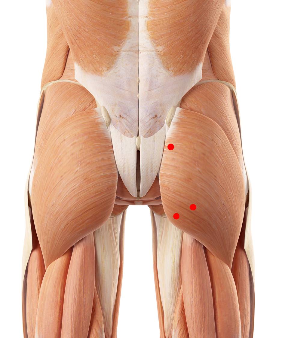 Triggerpunkte im großen Gesäßmuskel verursachen tiefe Kreuzschmerzen und Beschwerden beim Sitzen.