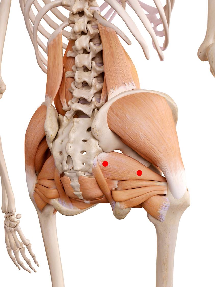 Triggerpunkte im Piriformis-Muskel verursachen Schmerzen im Gesäß, die durch Gehen, Stehen oder Sitzen zunehmen. Außerdem kann durch eine Verhärtung der Ischiasnerv gedrückt werden, was zu einer Ischialgie (Piriformis-Syndrom) führt.